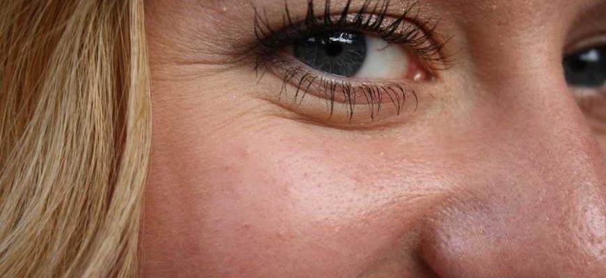 Дело не в возрасте: почему появляются морщины вокруг глаз и как этого избежать
