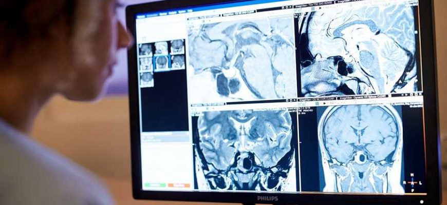 В День знаний ученые НИИ неотложной детской хирургии и травматологии поделятся результатами исследования черепно-мозговой травмы у детей
